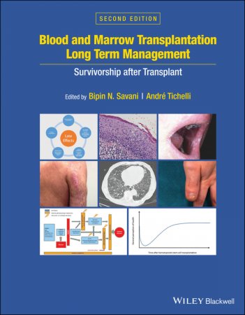 Blood and Marrow Transplantation Long Term Management. Survivorship after Transplant