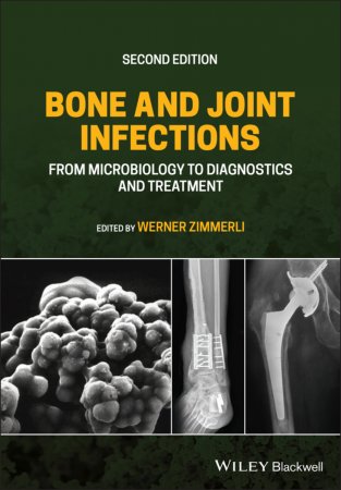 Bone and Joint Infections. From Microbiology to Diagnostics and Treatment