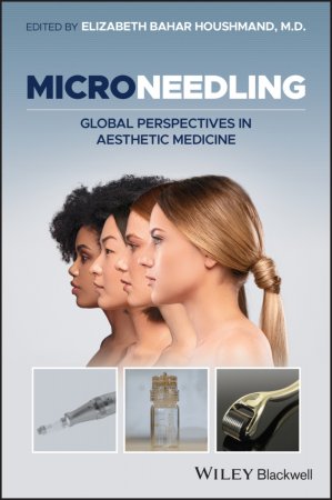 Microneedling. Global Perspectives in Aesthetic Medicine
